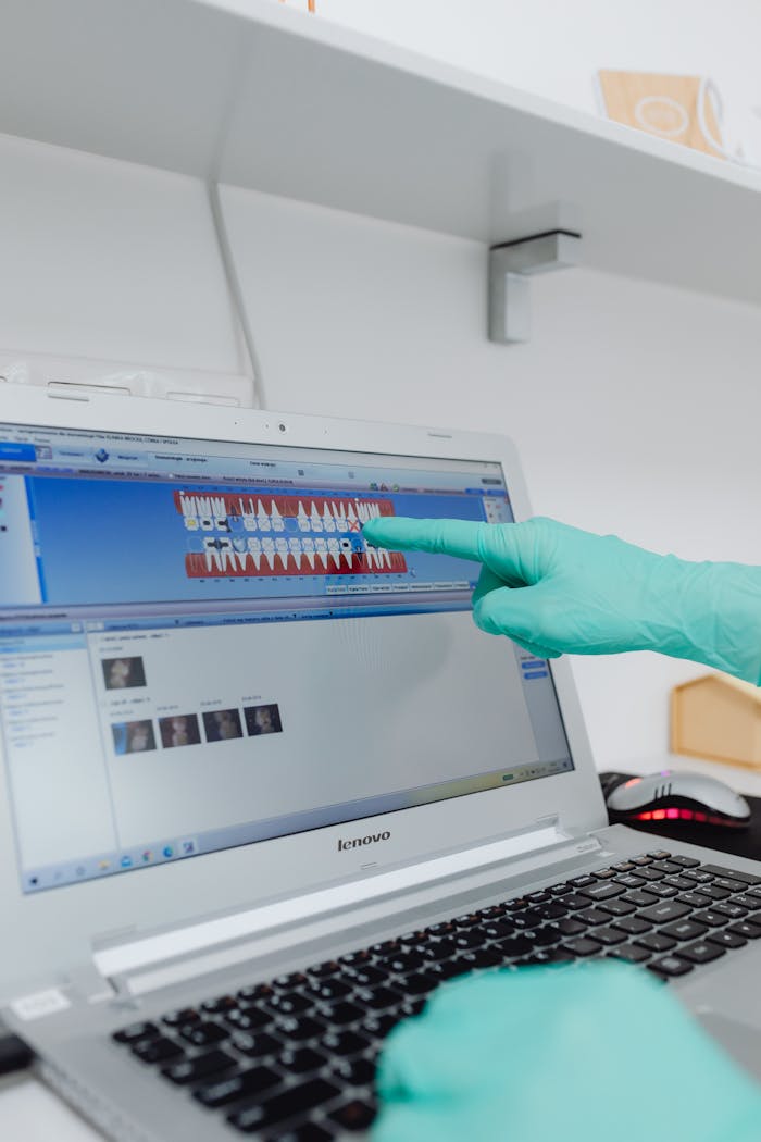 about-01 Gloved hand pointing at dental chart on a Lenovo laptop screen in a clinical setting.